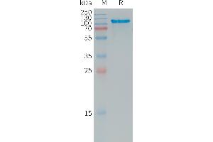 Human A Protein, His Tag on SDS-PAGE under reducing condition.