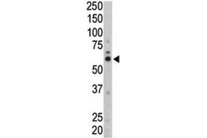 Western Blotting (WB) image for anti-FYN Oncogene Related To SRC, FGR, YES (FYN) (AA 13-43) antibody (ABIN3031009)