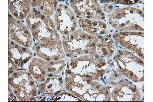 Immunohistochemical staining of paraffin-embedded Human prostate tissue using anti-ACAT2 mouse monoclonal antibody. (ACAT2 antibody)