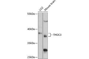 Western blot analysis of extracts of various cell lines, using THOC3 antibody (ABIN6128824, ABIN6149117, ABIN6149118 and ABIN6217153) at 1:3000 dilution. (THO Complex 3 antibody  (AA 1-200))