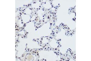 Immunohistochemistry of paraffin-embedded Mouse lung using PLZF antibody (ABIN6128472, ABIN6150368, ABIN6150369 and ABIN6221570) at dilution of 1:200 (40x lens).