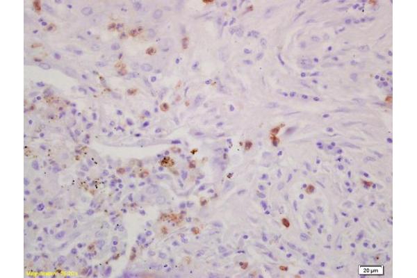 IGBP1 antibody  (AA 151-250)