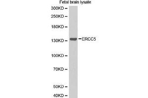 Western Blotting (WB) image for anti-DNA Repair Protein Complementing XP-G Cells (ERCC5) (AA 1-270) antibody (ABIN1512873) (ERCC5 antibody  (AA 1-270))