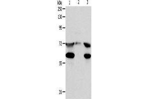 Western Blotting (WB) image for anti-Coiled-Coil Domain Containing 99 (CCDC99) antibody (ABIN2422193) (CCDC99 antibody)