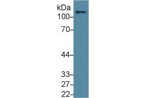 Detection of FAK in Human Jurkat cell lysate using Polyclonal Antibody to Focal Adhesion Kinase (FAK) (FAK antibody  (AA 798-1041))