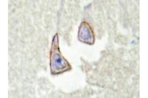 Immunohistochemistry analysis of KSR2 in human brain tissue (Formalin-fixed, Paraffin-embedded) using Kinase suppressor of Ras 2 antibody . (KSR2 antibody)