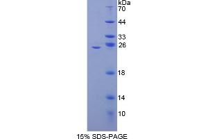 SDS-PAGE analysis of Mouse NFkB2 Protein. (Nuclear Factor kappa B2 Protein)