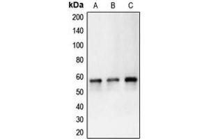 Western blot analysis of Carbonic Anhydrase 9 expression in HeLa (A), Ramos (B), Molt4 (C) whole cell lysates.