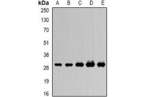 Western blot analysis of RISP expression in SW620 (A), MCF7 (B), mouse heart (C), mouse ovary (D), rat kidney (E) whole cell lysates. (UQCRFS1 antibody)