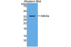 Western Blotting (WB) image for anti-Tumor Necrosis Factor Receptor Superfamily, Member 11a, NFKB Activator (TNFRSF11A) (AA 330-615) antibody (ABIN3205543) (TNFRSF11A antibody  (AA 330-615))