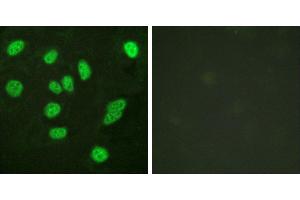 Peptide - +Western blot analysis of extracts from A549 cells, using B-Myb (Ab-577/581) antibody. (MYBL2 antibody  (Ser577))