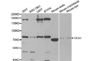 Western Blotting (WB) image for anti-P Protein (OCA2) antibody (ABIN1876854) (OCA2 antibody)