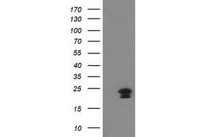 HEK293T cells were transfected with the pCMV6-ENTRY control (Left lane) or pCMV6-ENTRY HAND1 (Right lane) cDNA for 48 hrs and lysed. (HAND1 antibody)