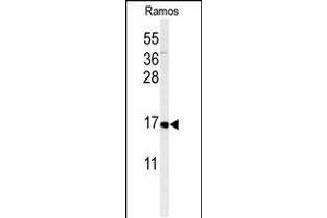 Western blot analysis of CMTM7 Antibody in Ramos cell line lysates (35ug/lane) (CMTM7 antibody  (N-Term))