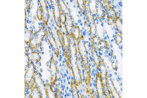 Immunohistochemistry of paraffin-embedded Mouse kidney using DNA Polymerase beta antibody (ABIN3022384, ABIN3022385, ABIN3022386, ABIN1513390 and ABIN1514536) at dilution of 1:100 (40x lens). (POLB antibody  (AA 1-335))