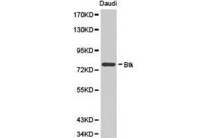 Western Blotting (WB) image for anti-Bruton Agammaglobulinemia tyrosine Kinase (BTK) antibody (ABIN1871367) (BTK antibody)