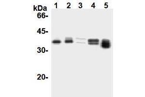Western Blotting (WB) image for anti-Cyclin D1 (CCND1) antibody (ABIN1106871) (Cyclin D1 antibody)