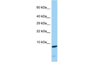 Host: Rabbit Target Name: CDC42SE2 Sample Type: COLO205 Whole Cell lysates Antibody Dilution: 1. (CDC42SE2 antibody  (Middle Region))