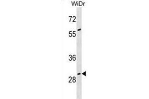 Western Blotting (WB) image for anti-Growth Arrest-Specific 2 (GAS2) antibody (ABIN3000565)