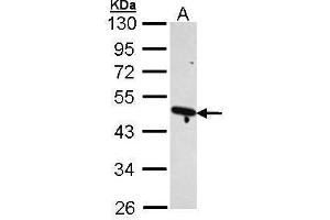 WB Image Sample (30 ug of whole cell lysate) A: H1299 10% SDS PAGE antibody diluted at 1:1000 (ACTR2 antibody)