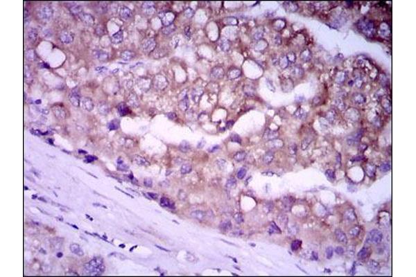 Glypican 3 antibody