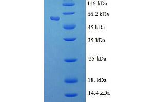 RBBP7 Protein (AA 1-425, full length) (His-SUMO Tag)