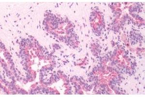 Human, Prostate: Formalin-Fixed Paraffin-Embedded (FFPE) (GPRC5A antibody  (Cytoplasmic Domain))