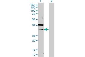 Western Blot analysis of RAB7A expression in transfected 293T cell line by RAB7A MaxPab polyclonal antibody. (RAB7A antibody  (AA 1-207))