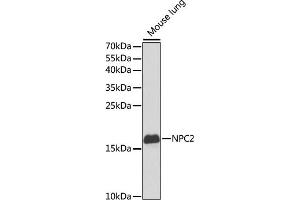 Western blot analysis of extracts of mouse lung, using NPC2 antibody (ABIN6131887, ABIN6144762, ABIN6144763 and ABIN6221063) at 1:1000 dilution. (NPC2 antibody  (AA 20-151))