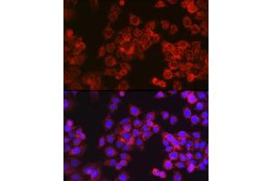 Immunofluorescence analysis of HeLa cells using CPT1A Rabbit pAb (ABIN6130129, ABIN6138976, ABIN6138977 and ABIN6220929) at dilution of 1:100 (40x lens). (CPT1A antibody  (AA 497-756))