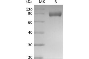 Western Blotting (WB) image for Sialic Acid Binding Ig-Like Lectin E (Siglece) protein (Fc Tag) (ABIN7320926) (Siglec E Protein (Fc Tag))