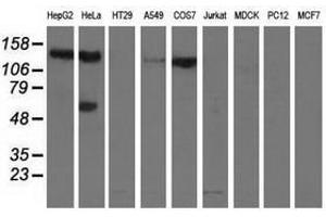 Image no. 2 for anti-L1 Cell Adhesion Molecule (L1CAM) antibody (ABIN1499090) (L1CAM antibody)