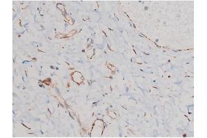 ABIN6267465 at 1/200 staining Human esophagus tissue sections by IHC-P. (CDC25A antibody  (pSer124))