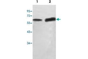 Western blot analysis of HepG2 cell (Lane 1) and human fetal testis (Lane 2) lysate with SCP2 polyclonal antibody  at 1 : 500 dilution. (SCP2 antibody  (AA 303-536))