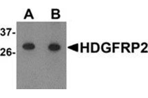 Western blot analysis of HDGFRP2 in human testis tissue lysate with HDGFRP2 antibody at (A) 0. (HDGFRP2 antibody  (N-Term))