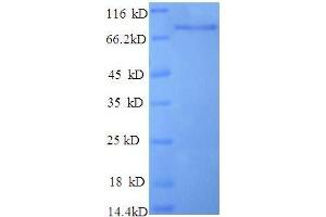 Enolase 1, (Alpha) (ENO1) (AA 2-428), (partial) protein (GST tag) (ENO1 Protein (AA 2-428, partial) (GST tag))