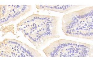 Detection of ACE2 in Mouse Small intestine Tissue using Polyclonal Antibody to Angiotensin I Converting Enzyme 2 (ACE2) (ACE2 antibody  (AA 93-464))