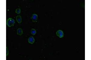 Immunofluorescent analysis of MCF-7 cells using ABIN7160242 at dilution of 1:100 and Alexa Fluor 488-congugated AffiniPure Goat Anti-Rabbit IgG(H+L) (SMAD5 antibody  (AA 1-209))