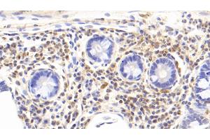 Detection of IL17 in Rabbit Colon Tissue using Monoclonal Antibody to Interleukin 17 (IL17) (IL-17 antibody  (AA 21-153))