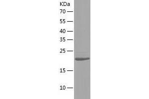 Western Blotting (WB) image for Nudix (Nucleoside Diphosphate Linked Moiety X)-Type Motif 5 (NUDT5) (AA 1-219) protein (His tag) (ABIN7124246) (NUDT5 Protein (AA 1-219) (His tag))