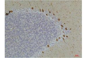 Immunohistochemistry (IHC) analysis of paraffin-embedded Human Brain Tissue using Ghrelin Receptor Rabbit Polyclonal Antibody diluted at 1:200.