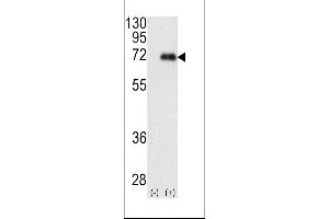 Western blot analysis of PRKCI using rabbit polyclonal PKC iota Antibody using 293 cell lysates (2 ug/lane) either nontransfected (Lane 1) or transiently transfected with the PRKCI gene (Lane 2).