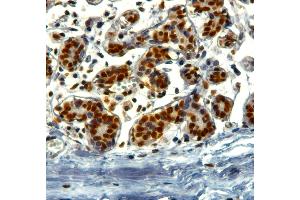 ABIN184913 (2µg/ml) staining of paraffin embedded Human Breast. (KAP1 antibody  (C-Term))