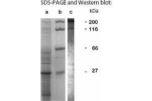 Western Blotting (WB) image for anti-LCCL Domain-Containing Protein CCP3 (LAP1) antibody (ABIN197620) (SRCR antibody)