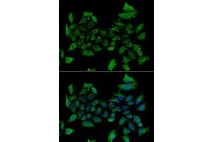 Immunofluorescence analysis of HeLa cells using ALAS1 antibody. (ALAS1 antibody)