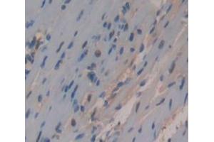 Immunohistochemistry (IHC) image for anti-Heterogeneous Nuclear Ribonucleoprotein A1 (HNRNPA1) (AA 2-320) antibody (ABIN5013693)