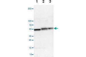 Western blot anyalysis of Lane 1: NIH-3T3 cell lysate (Mouse embryonic fibroblast cells), Lane 2: NBT-II cell lysate (Rat Wistar bladder tumour cells), Lane 3: PC12 cell lysate (Pheochromocytoma of rat adrenal medulla) with UQCRC1 polyclonal antibody . (UQCRC1 antibody)