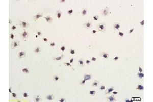 Gastric Cancer Cells labeled with Anti-Smac/DIABLO Polyclonal Antibody, Unconjugated (ABIN674619) followed by conjugation to the secondary antibody (DIABLO antibody  (AA 131-239))