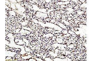 Formalin-fixed and paraffin embedded chicken lung labeled with Anti ApoER2 Polyclonal Antibody, Unconjugated (ABIN719426) at 1:200 followed by conjugation to the secondary antibody and DAB staining (LRP8 antibody  (AA 851-963))
