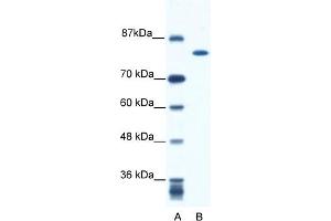 WB Suggested Anti-KIF23 Antibody Titration:  0. (KIF23 antibody  (N-Term))